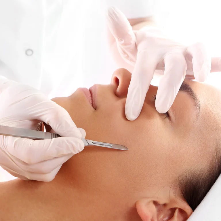 Dermaplaning